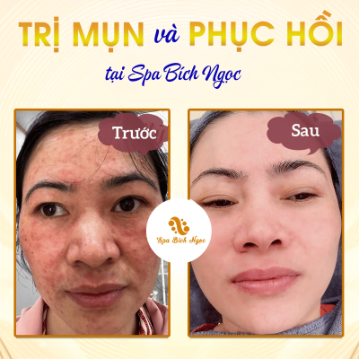 Spa-bich-ngoc-vinh-bao