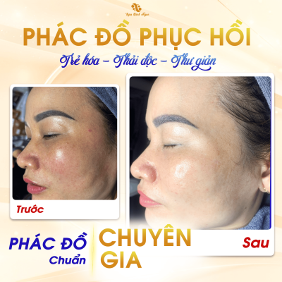 Phục hồi da tại Spa Bích Ngọc Vĩnh Bảo