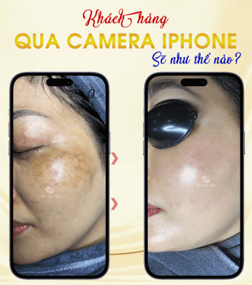 Phục hồi da tại Spa Bích Ngọc Vĩnh Bảo