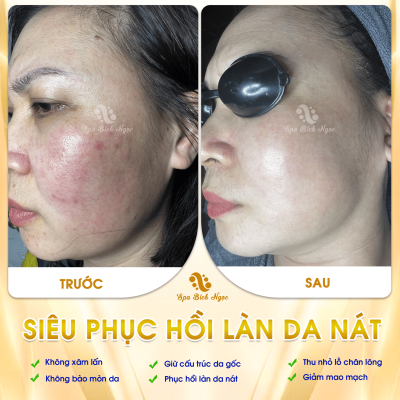 Spa-bich-ngoc-vinh-bao