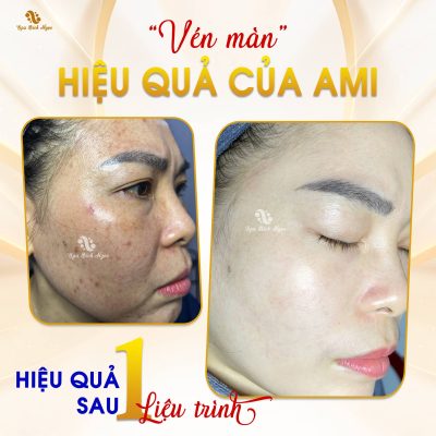 ami-spa-bich-ngoc