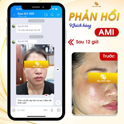 ami-spa-bich-ngoc