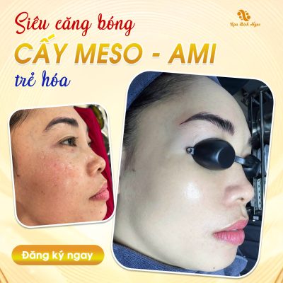 ami-spa-bich-ngoc
