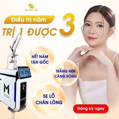 laser-picosure-spa-bich-ngoc