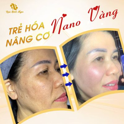 nano-ultra-spa-bich-ngoc
