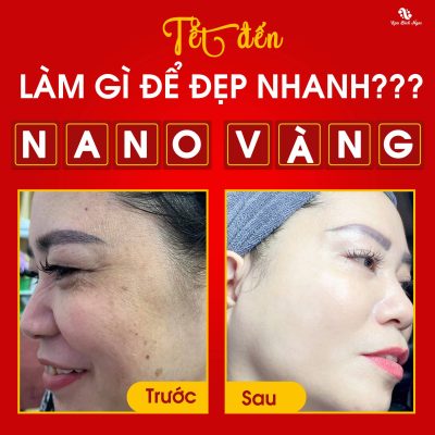 nano-ultra-spa-bich-ngoc