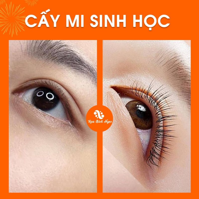 truoc-sau-spa-bich-ngoc