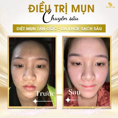 Tao-xoan-spa-bich-ngoc