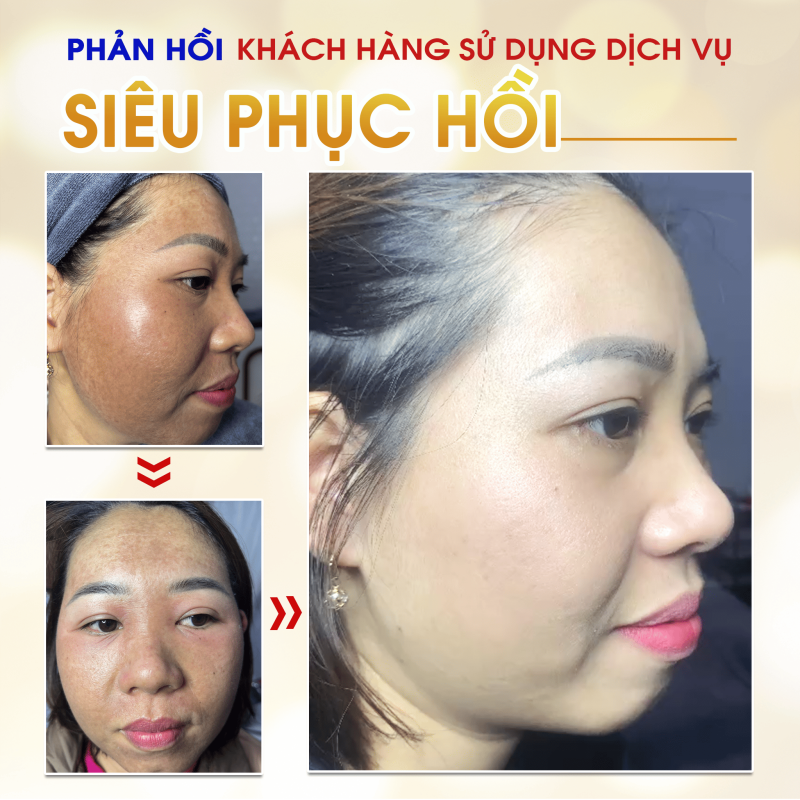 Spa-bich-ngoc-vinh-bao