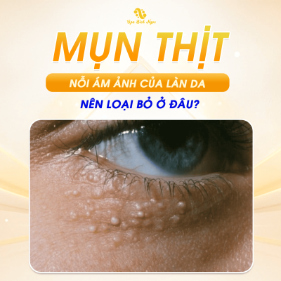 dot-mun-thit-spa-bich-ngoc